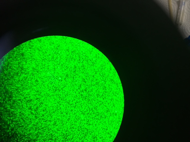 MMMs Droplets under scope 3_15_16