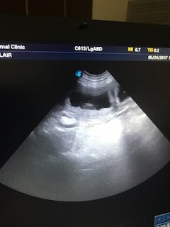 ty ultrasound