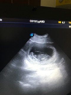 ty ultrasound1